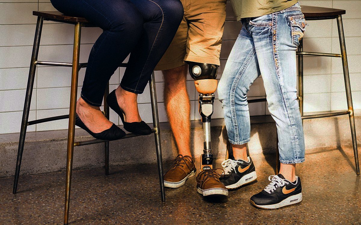 Člověk s nohou - protézou s dalšími lidmi / Photo by Elevate on Unsplash
